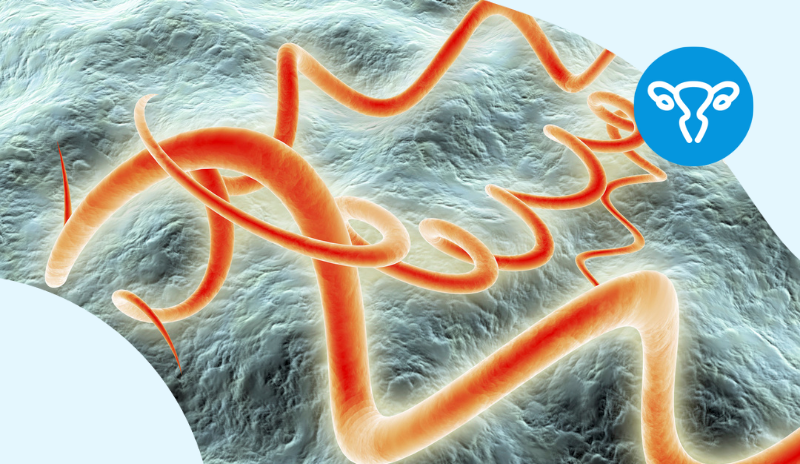 Cisti di Bartolini cosa sono, come curarle Doctolib