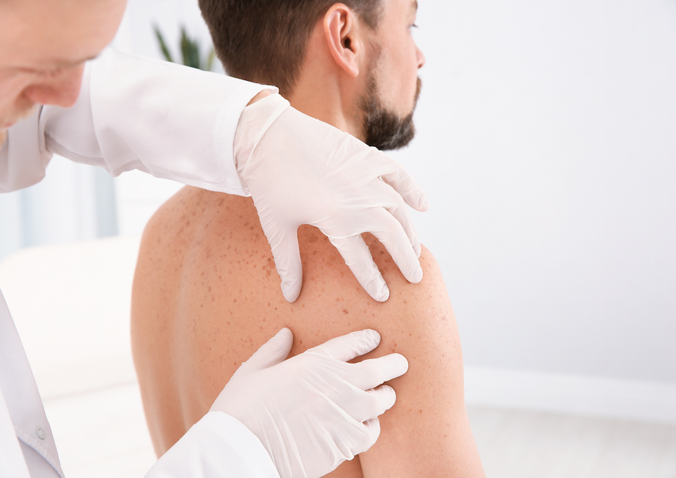 Eine Ärztin in weißem Kittel untersucht mit Handschuhen den Rücken eines männlichen Patienten auf Hautveränderungen